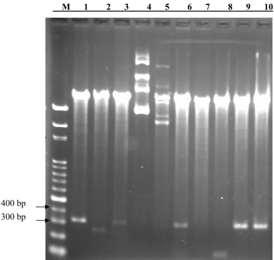 Figure 8. Restriction enzyme digestion of the pAAV-CEA-m3 construct. The plasmid was  digested by EcoRI and XhoIII into a 309 bp fragment