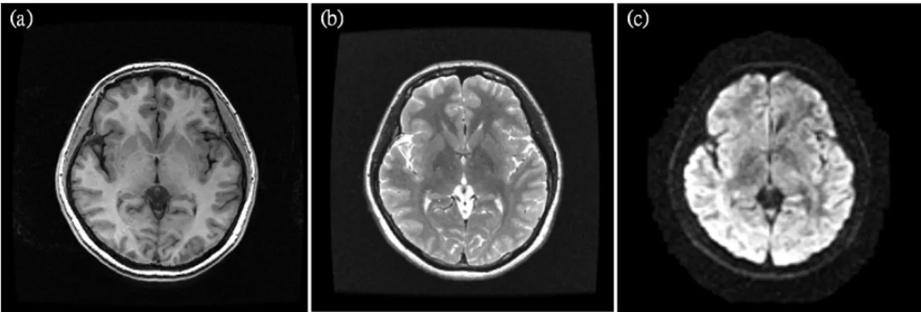 Figure 1.1: MR images acquired using different pulse sequences. (a) T1-weighted MR image