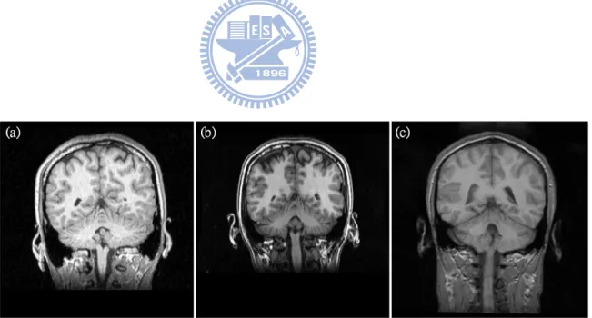 Figure 1.4: T1-weighted MR images acquired from different scanners present quite differ- differ-ent intensity properties