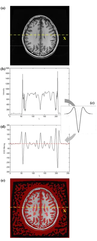 Figure 2.2: The TDOG foreground reveals the regions with relatively low intensities. (a) One axial slice of a T1-weighted MR brain image