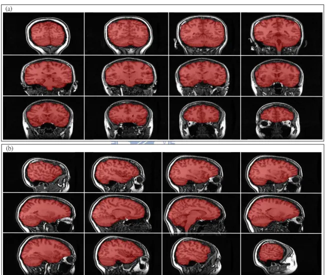 Figure 2.7: Brain extraction results of a T1-weighted image shown in (a) coronal and (b) sagittal views.