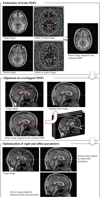 Figure 3.1: Flowchart of the proposed afﬁne registration method. The brain MSPs in the source and target images are determined according to the TDOG images and are then  over-lapped together