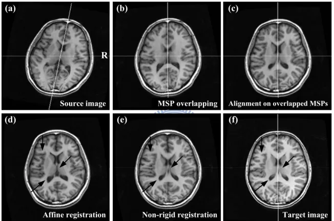 Figure 3.2: Registration between the source image (a) and the target image (f) by using the proposed BIRT methods