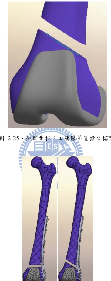 圖 2-25、斜斷骨折人工膝關節置換後模型 