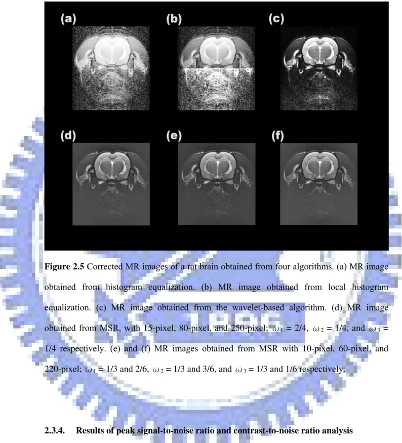 Figure 2.5 Corrected MR images of a rat brain obtained from four algorithms. (a) MR image  obtained from histogram equalization