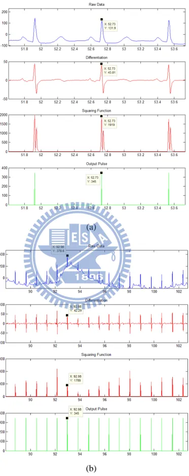 Figure 3.11    Resulting output from each stage of the QRS detection algorithm for  (a) clean ECG signal and (b) ECG signal with motion artefact