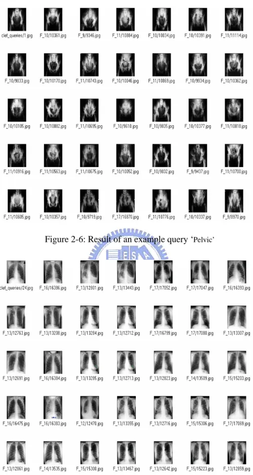 Figure 2-6: Result of an example query ‘ Pelvic’