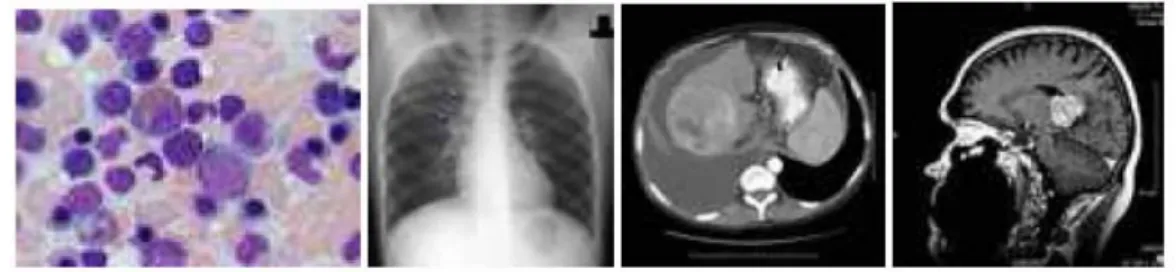 Figure 3-1 shows a few example images from the database. These images are  among others the query topic for the performance evaluation
