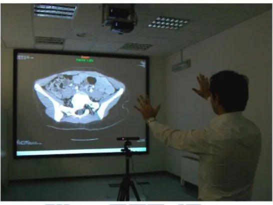 Fig. 2-6. Controller-free interactive exploration of medical through Kinect [19]. 