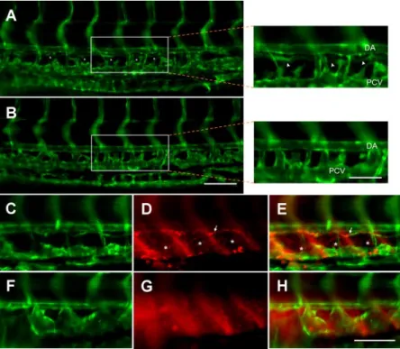 Figure 5. Knockdown of zlpa 1 inhibits forma- forma-tion of the thoracic duct, thus preventing lymphatic uptake