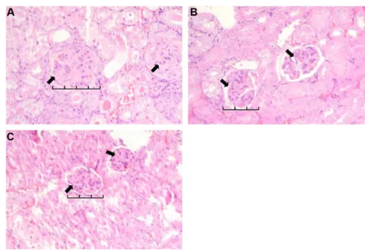 Figure 4 Renal histological change of MRL-lpr/lpr mice supplemented without (A, control) or with alfalfa sprout ethyl acetate extract (B, ASEA) or tamoxifen (C) for 6 weeks