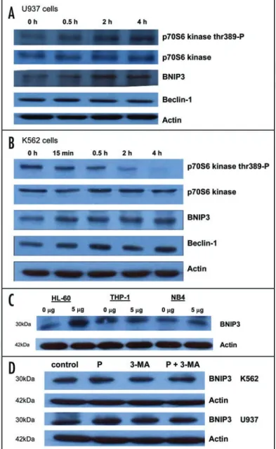 Figure 7. Expression of autophagy regulatory proteins in leukemic cells. Cells  were treated with 5 μg/mL platonin for 2 h and harvested for western blot  analysis