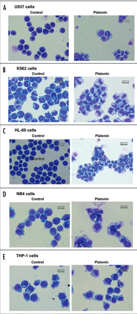 Figure 1. Morphological changes of leukemic cells. (A) U937; (B)  K562; (C) HL-60; (D) NB4; (E) THP-1 cells