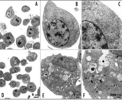 Figure 2. TEM microphotographs showing the ultrastructure of 10 μg/mL platonin-treated U937  leukemic  cells