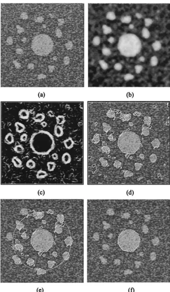 Fig. 6. (a) A synthetic image with simulated speckle, the CNR of which is about 3; (b) despeckled image derived by using 10-level Gaussian filters; (c) gradient map obtained by applying the Sobel edge detector to the despeckled image; (d) cells generated b