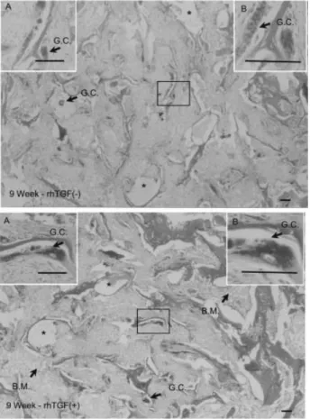 FIG. 3. Photomicrograph, made at 9 weeks, of a defect filled  with collagen-hydroxyapatite/tricalcium phosphate (Col-HA/TCP) microspheres containing 0 or 10 mg of rhTGF-b 1.