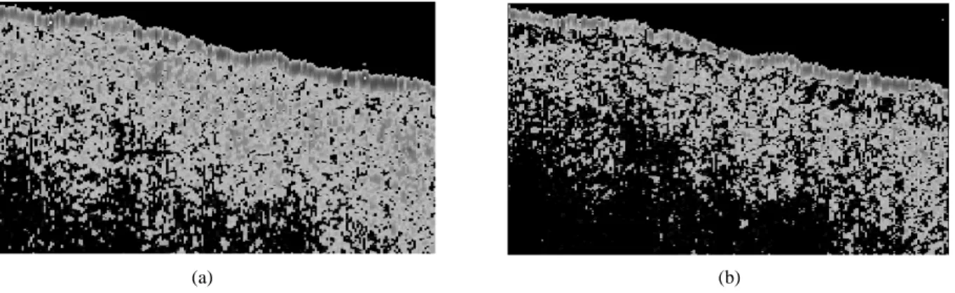 Fig. 2: A part of the OCT image of the cancerous human oral mucosa (a) becomes clearer in detailed features after the process through our algorithm (b).