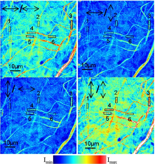 Fig. 3. Multiphoton polarization imaging of skin dermal fiber layers (I max =100, I min =0)  Table