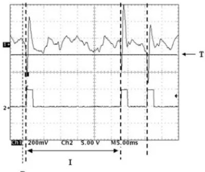 Fig. 1. Illustration of spike-trigger acquisition. The multi-unit recording is shown in the upper trace and the lower trace is the output TTL pulses from a window discriminator