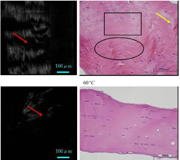Fig. 1 Selected second harmonic generation (SHG) images (left column) and histological images (right column)    of thermally treated rat tail tendon treated for 10 minutes in PBS buffer