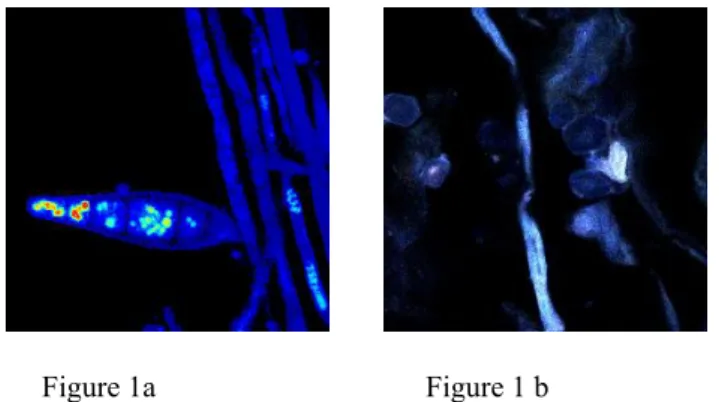 Figure 1a                                    Figure 1 b                 