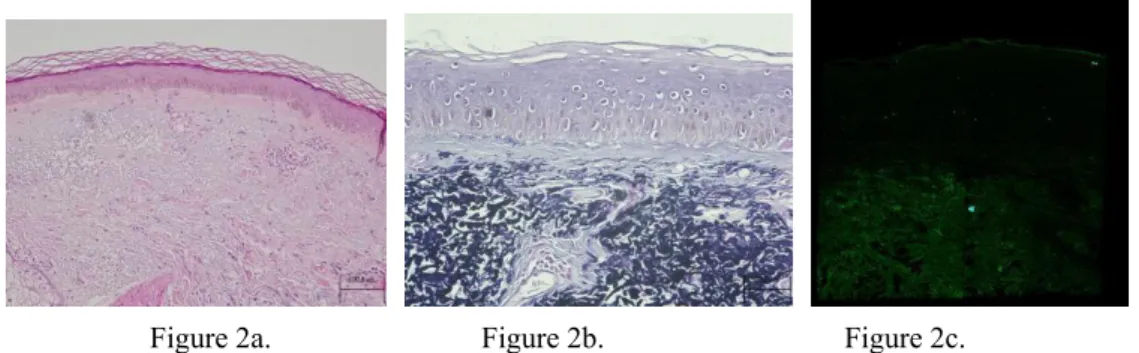 Figure 2a.                            Figure 2b.                                Figure 2c