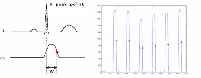 Fig. 3.10: The corresponding relation between ECG raw data and the signals after moving  window average 