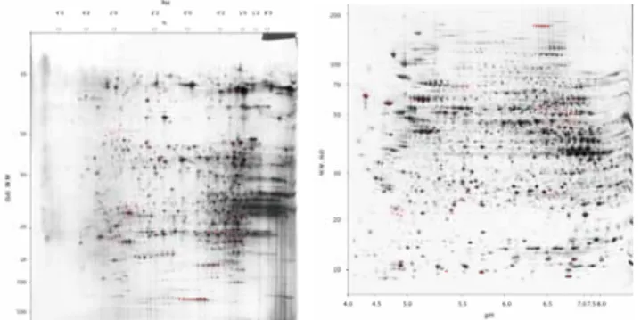 Figure 5. 2D PAGE of normal liver (left panel) and HepG2 (right panel).   