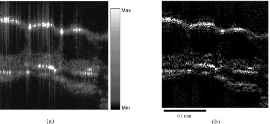 Fig. 5 (a) An OCT image of onion cells before process. (b) The OCT image after process with the ret rieval algorithm.