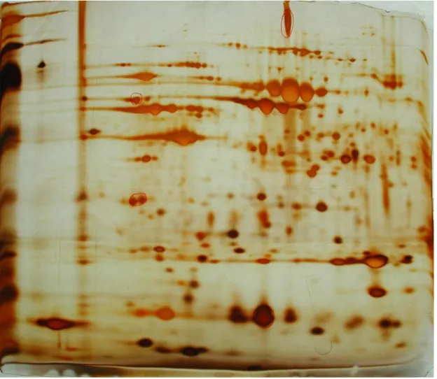 Fig. 1：whole-cell protein spots on the 2-DE gel of H. pylori strain associated with the  DU patient 