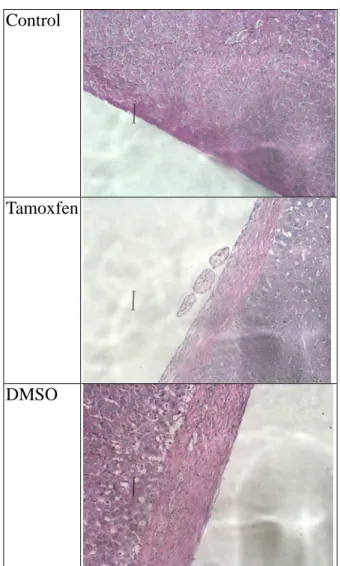 Fig. 4: The visceral peritoneum thickness  around the liver surface.    The thickness of  control group was significantly less than the  tamoxifen (T) and bleach vehicle (D) groups 