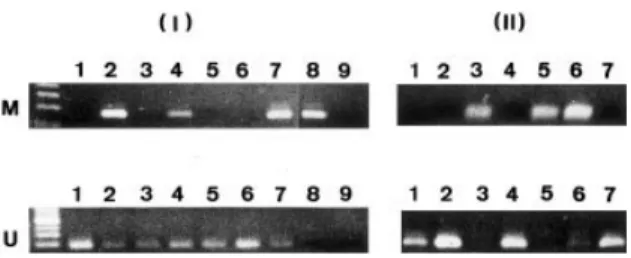 Figure 1. Methylation-speciﬁc polymerase chain reaction analysis of the SOCS1 promoter region in 12 patients with newly diagnosed AML (left panel: lanes 1 to 5 in experiment I; right panel: lanes 1 to 7 in experiment II)