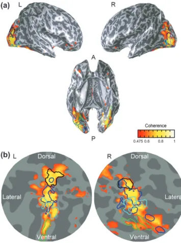 Figure 6. Activation maps for upright faces versus inverted faces averaged across observers (a) on 3 views of the inflated brain and (b) occipital-pole flatmaps