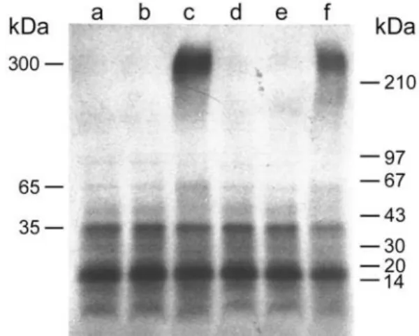Figure 2. Effect of [D-Trp 6 ]LHRH and RC-160 on basal and EGF-induced ovarian tumor ascites protein phosphorylation