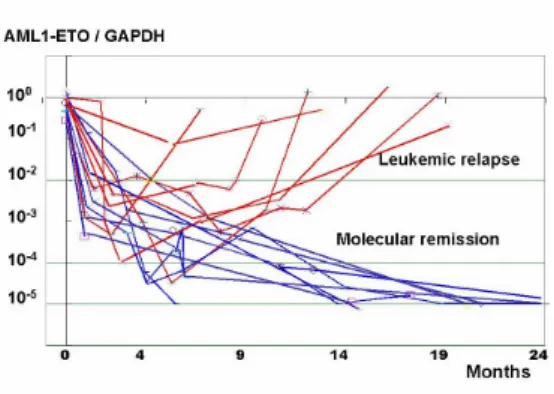 Fig  3.  Molecular  remission  induced  by  graft-versus  leukemia  (GVL)  effect  after  BMT  in  patient  4