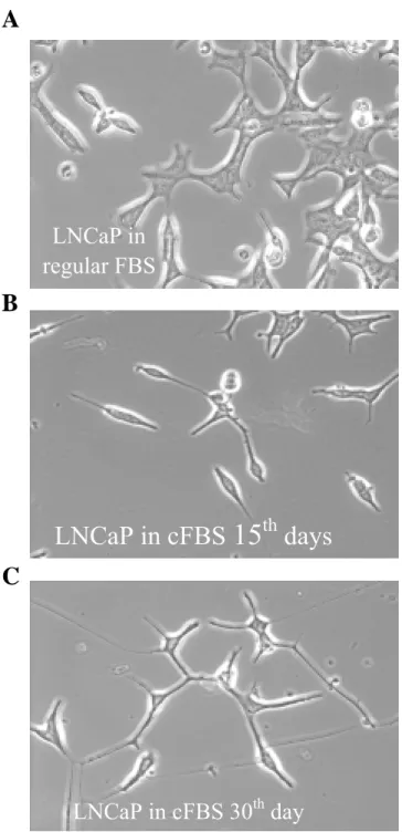 Figure 1.  A  B  C  LNCaP in cFBS 30 th  dayLNCaP in cFBS 15th  days LNCaP in regular FBS