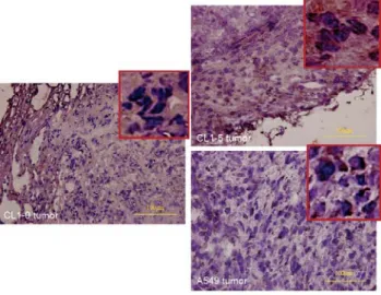 Figure 2. The immunohistochemical staining of EGFR in various tumor cell line in SCID mice