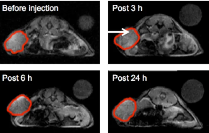 Figure 3.  In vivo progressive MRI events. T 2 *-weighted images of male SCID mice administrated with  Fe 3 O 4  nanoparticles conjugated with anti-EGFR antibody at the indicated temporal points (pre-injection, 3 h,  6 h and 24 h) (The white arrows indicat