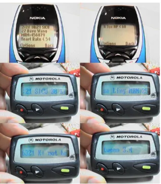 Figure 5: Messaging results on the mobile phone  and pager. The message showed on the mobile  phone (above two pictures) is “2/28 10:21 SICU 27  Dave Wang MRN=456789 Heart Rate < 54 &amp; Sys  BP < 60”