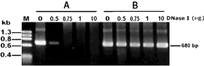 Fig. 2. Effect of DNase concentration on pGL digestion. An aliquot of 1 µg pGL was incubated with 0.5, 0.75, 1, or 10 µg DNase in a 100 µl solution at 37°C for 1 hr
