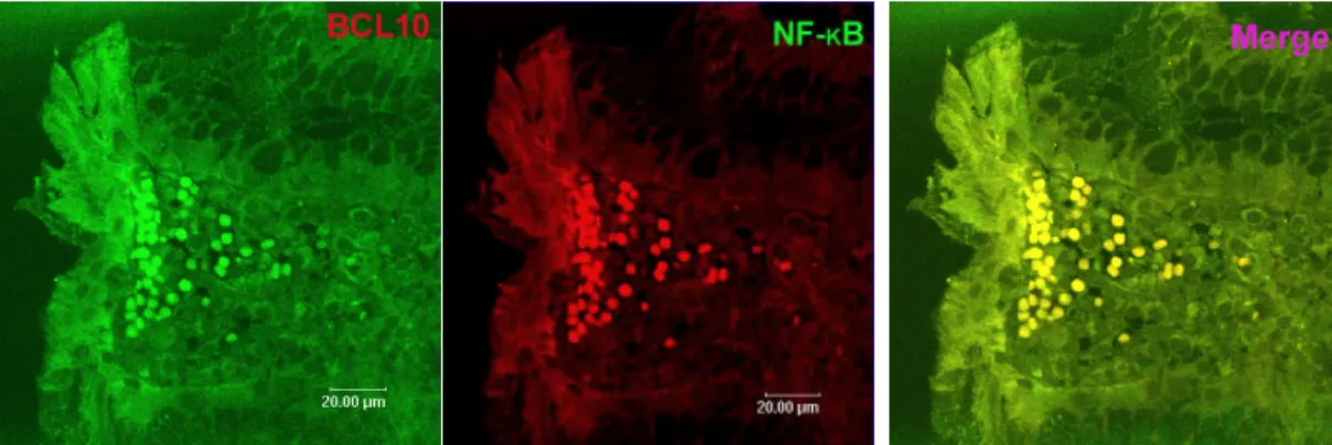 Fig. 2: Co-localization of BCL10 and NF-kB.    The nuclear expression of BCL10  (green) and NF-B (red) in the tumor cells of HPi-independent cases analyzed by  confocal microscopy