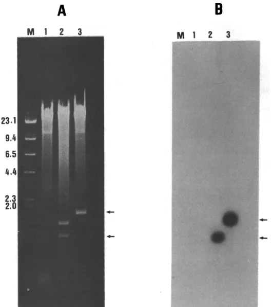 Fig. 3. Southern blot analysis of the DNA insert isolated from the lambda gtl0 clones