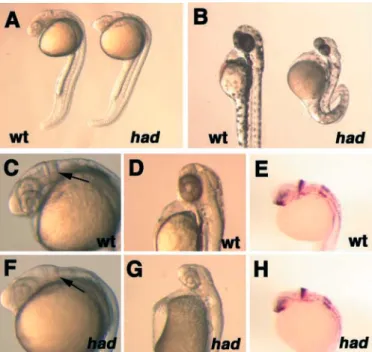 Fig. 2. Primitive heart tube extension is perturbed in had mutant embryos. (A-F) All panels show dorsal views, anterior to the bottom.