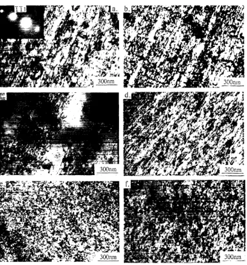 Fig.  5.  T E M   micrographs  showing  the  deformation  structure  after  4%  plastic  strain  for  the  various  tempers