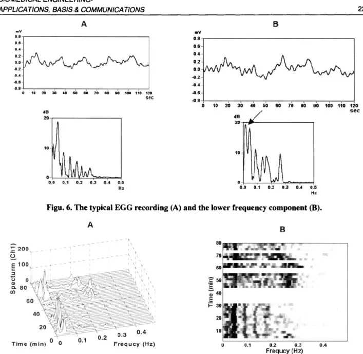 Fig. 7 Running spectrum analysis of the same data as in Figure 6 . The pseudo-3D plot (A) and a grayscale plot (B)