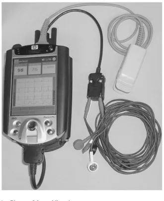 Fig. 4. Picture of the mobile unit.
