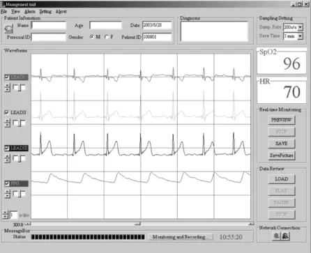 Fig. 8. Main control window and vital-sign signals display of the management unit.