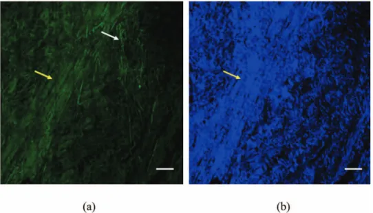 Fig. 1 Multiphoton 共a兲 AF and 共b兲 SHG images of foreskin dermis. SHG signals are blue and AF signals are green.