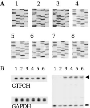 Figure 2. Detection of GTPCH R249S mutation. (A) GTPCH exon 6 PCR products were sequenced either directly (panels 1-3) or after cloning (panels 4-8)