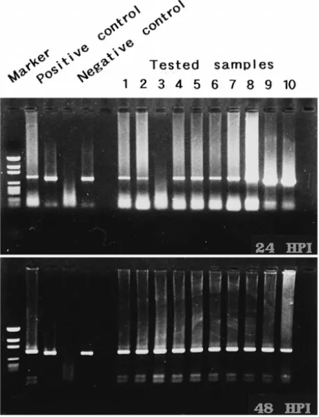 Fig. 9. Detection of WSBV by PCR with WSBV-specific primer sets 146 F2 and 146 R2 using DNA extracts from young adult P